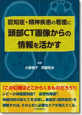 認知症・精神疾患の看護に頭部CT画像からの情報を活かす